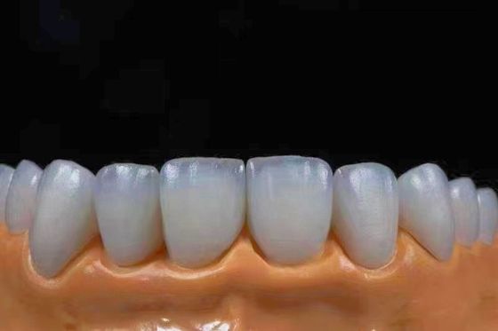 comprare Corone di zirconia estetica altamente traslucide, perfette per un aspetto naturale fabbricazione online