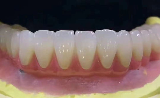 comprare Corone dentale di zirconia personalizzata resistente alle macchie con elevata precisione fabbricazione online