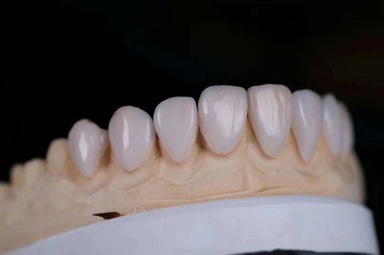 comprare Corona di zirconia in ceramica a più strati regolabile con certificazione FDA fabbricazione online