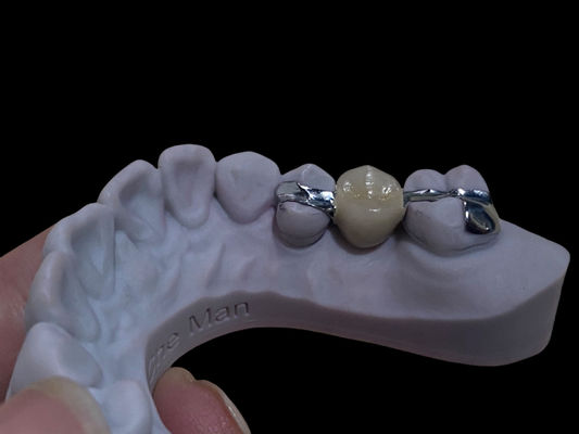 comprare Accurate bianche di lunga durata Maryland ponte dentale personalizzabile per il restauro fabbricazione online
