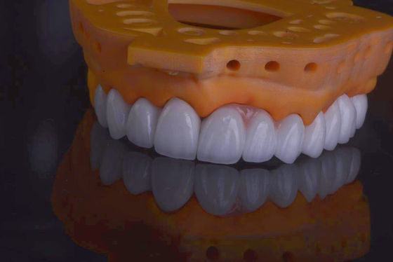 comprare Corone di laboratorio dentistiche di alta resistenza naturali in cerca di restauro dei denti fabbricazione online