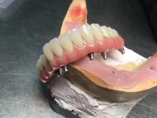 comprare Impianto solido ad alta traslucidità corone supportata personalizzabile per la restaurazione dentale fabbricazione online