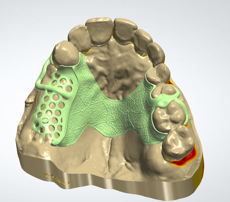 comprare Quadro digitale in metallo CAD CAM Disegno dentale Materiale Cocr con stampa 3D fabbricazione online