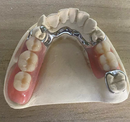 comprare Affidabile protesi di telaio metallo argento resistenza alla corrosione con design personalizzabile fabbricazione online