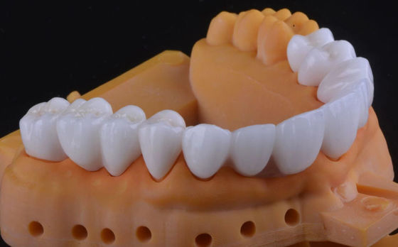 Corone dentale in zirconia ad alta resistenza, ultratraslucida e stabile a lungo termine