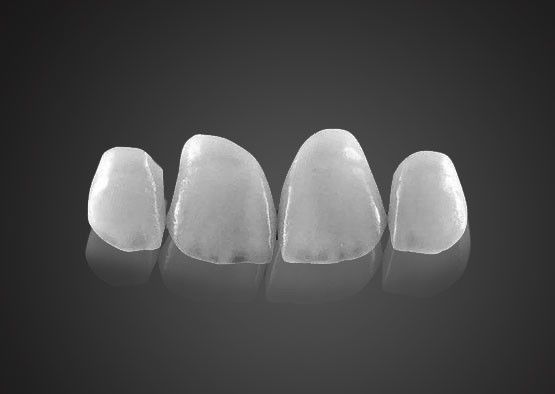 IPS 0.2mm Veneers Emax ultra sottili resistenti alle macchie con elevata resistenza