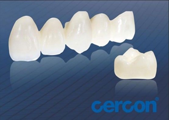 Resistenza all'usura CAM Coroane in cercone e zirconia Facile pulizia Alta biocompatibilità