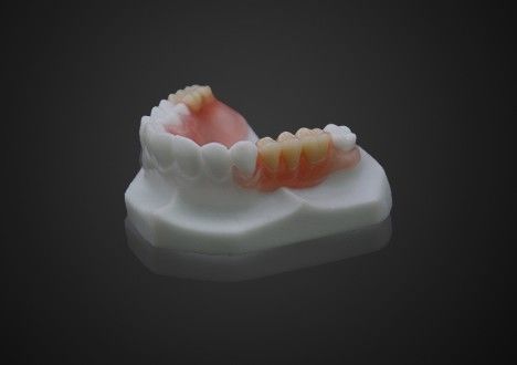 Leggera, confortevole, protesi parziali in Valplast, facile da pulire, trasparenza elevata