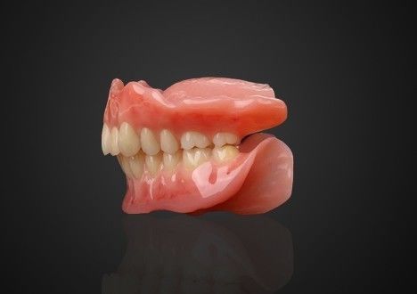 Dentiera parziale ad base acrilica ad assorbimento immediato rimovibile e comoda
