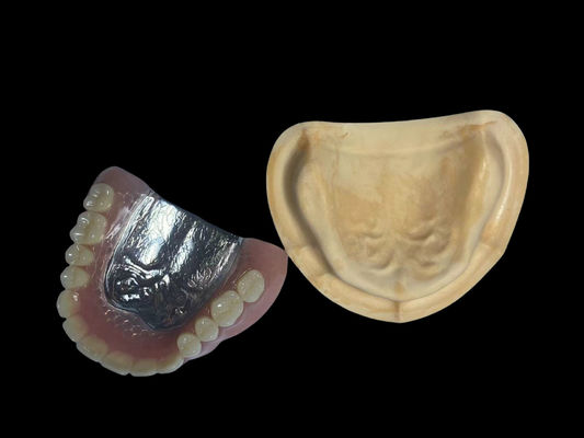 Riparazione parziale della protesi metallica rimovibile con denti acrilici Yamahachi