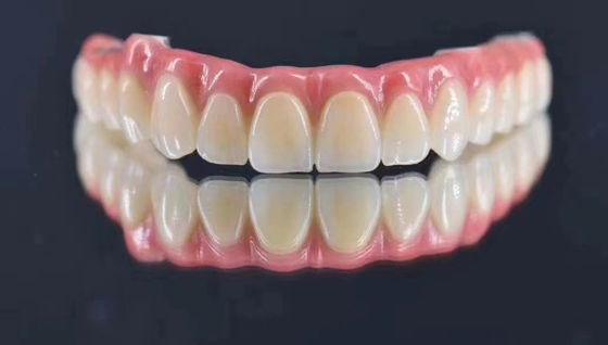 Laboratorio dentale Impianto personalizzato Corona di metallo naturale alla ricerca di stabilità a lungo termine