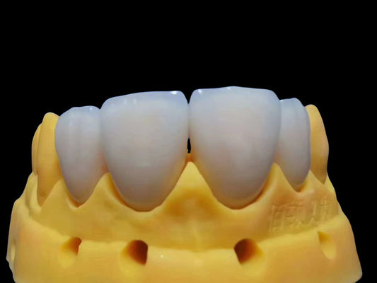 Fittura resistente alle lacrime Corona di zirconia completa personalizzabile Sicuro da usare