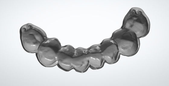 Conchiglia di uovo macinato CAD CAM Design dentale per impianto di ponte temporaneo PMMA
