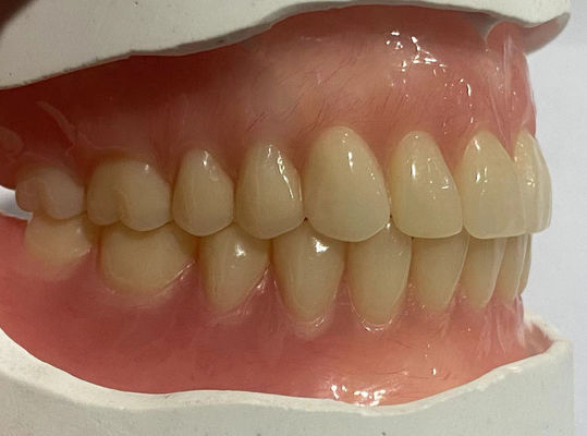Denti acrilici personalizzati dall'aspetto naturale per una conservazione ottimale