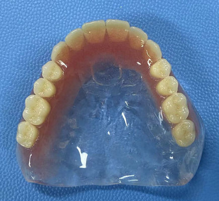 Resistenza alle macchie Protesi acrilica completa Alta stabilità con forma a arco completo