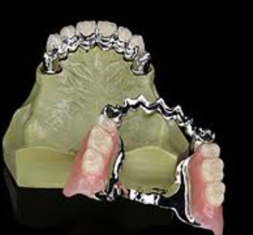 Lungo termine di utilizzo personalizzato chiave e chiavetta dentale con elevata resistenza