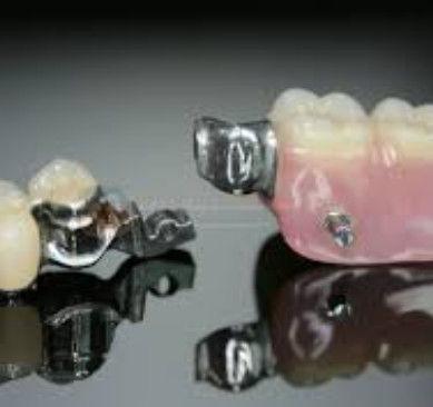 Alta flessibilità Mk1 Attachment Dental Alta precisione e sicurezza d'uso